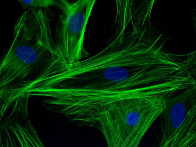 1200px-F-actin_filaments_in_cardiomyocytes.jpg